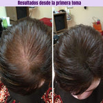 HairGrowth™: Suplemento para el crecimiento capilar avanzado
