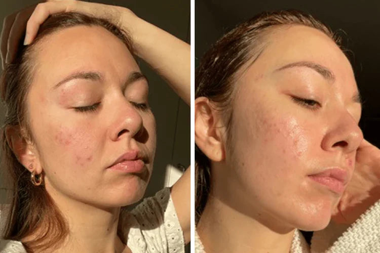 Crema Aclarante | ✨ Aclara tu Piel ✨ Resultados en una Semana!
