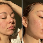 Crema Aclarante | ✨ Aclara tu Piel ✨ Resultados en una Semana!