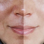 Crema Aclarante | ✨ Aclara tu Piel ✨ Resultados en una Semana!